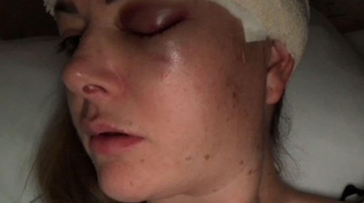 "No woman should be given depo jag without risk warning" Victims left mutilated hit out