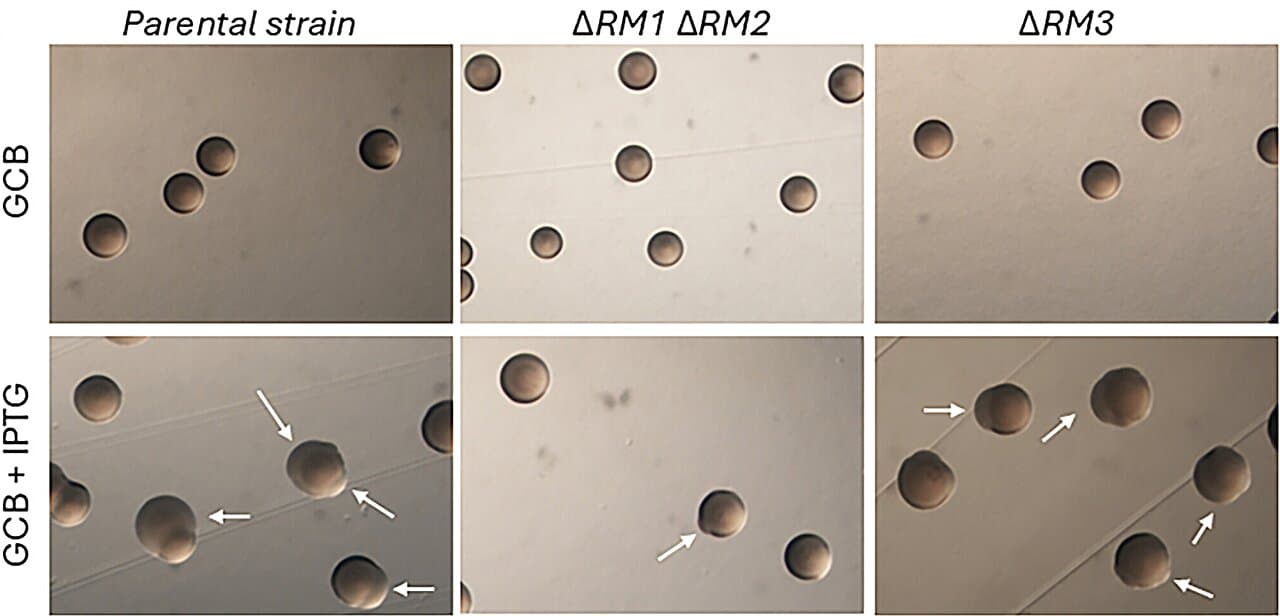 Intricate molecular mechanisms help bacteria evade immune detection
