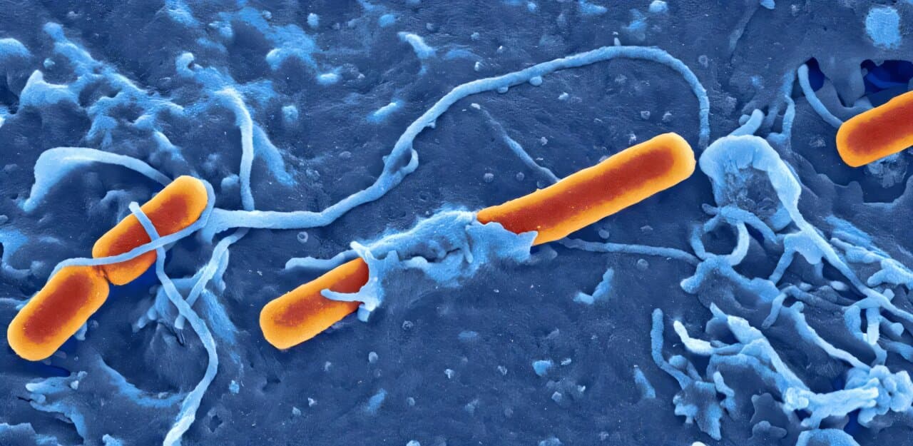 Sexually transmitted diarrhea spreading rapidly among some networks of gay men in the UK, study finds