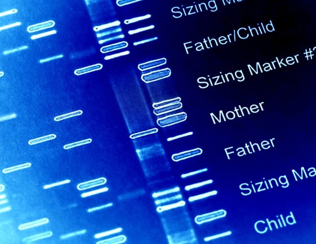 Genetic research reveals surprising metabolic pathway for irritable bowel syndrome