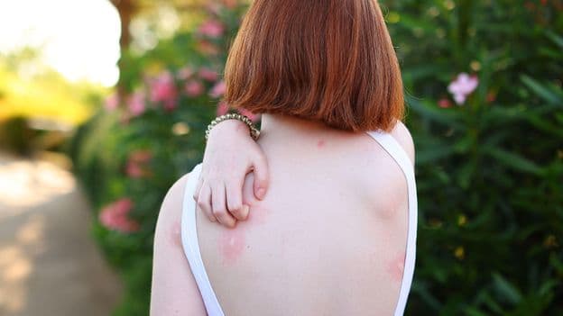 Why do mosquitoes bite some people more than others?