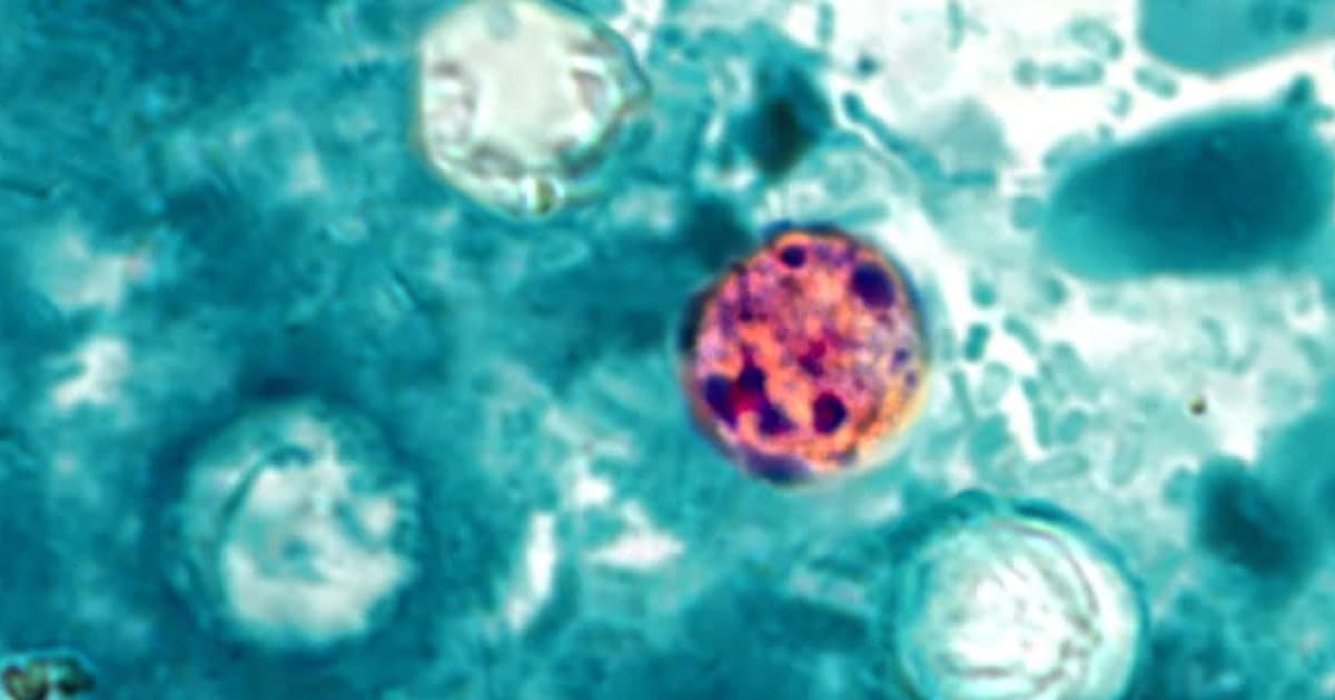 Nearly 7,000 cases of cyclosporiasis suspected nationwide, CDC says