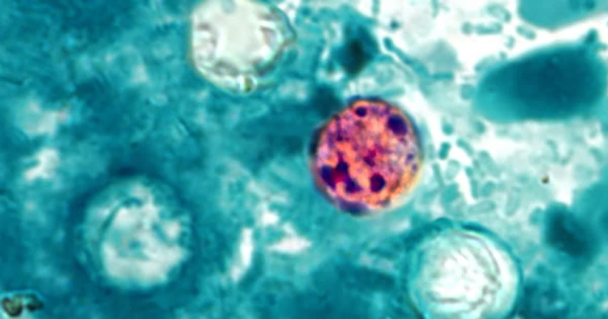 Dozens hospitalized with cyclosporiasis as cases of gastrointestinal illness spike in 31 states