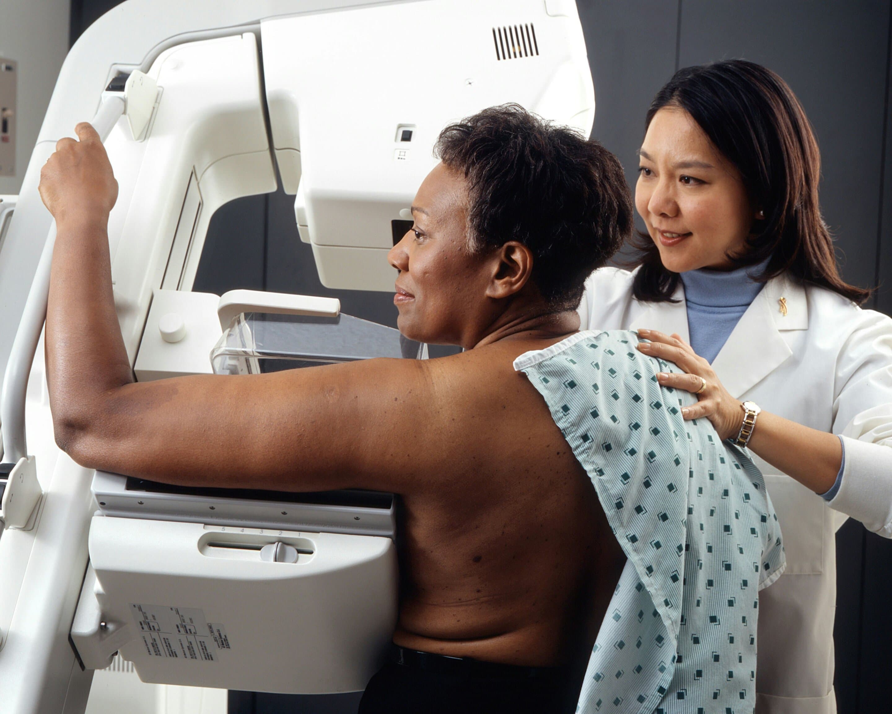 Black women need more help in accessing breast cancer screening