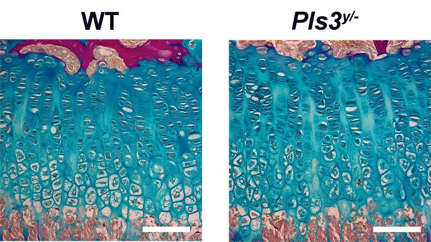 Genetic mapping identifies new hope for bone diseases