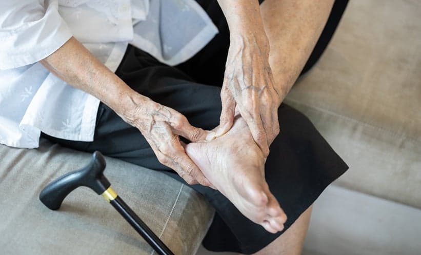 Sarcopenia Common in Rheumatoid Arthritis Patients