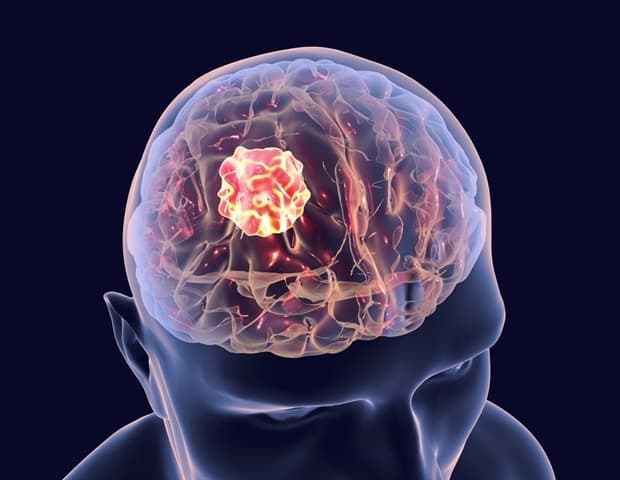 Experimental compound BA-101 overcomes chemotherapy resistance in glioblastoma