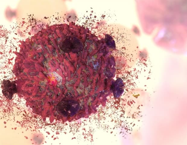 Combination treatment strategy uses cells' waste removal functions to dismantle multiple myeloma