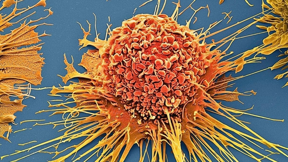 Scientists Destroy 99% of Cancer Cells in Lab Using Vibrating Molecules