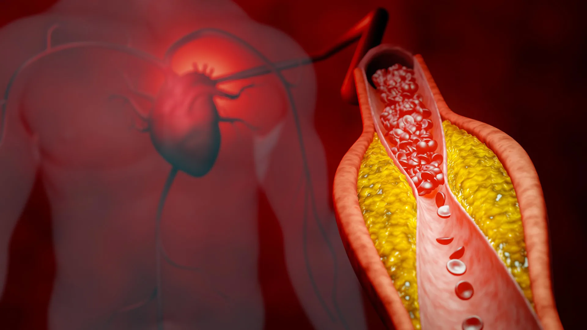 Millions may be getting the wrong cholesterol test